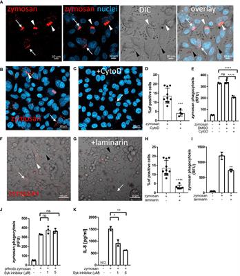 Human intestinal epithelial cells can internalize luminal fungi via LC3-associated phagocytosis